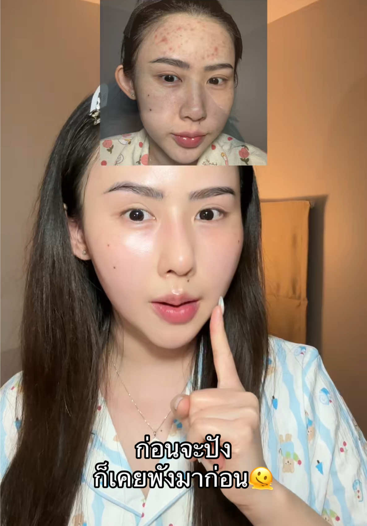 ตอบกลับ @จิราอยากสวย ซ้ำตลอดไปไม่เปลี่ยนใจแน่นอน🫶🏻 #ดูแลตัวเอง #น้ําตบลานอส #ป้ายยาtiktok #หน้าใส #ดูให้จบ 