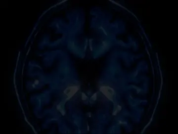 #tiktokknowledge #darkpsychology #cptsd #neuroscience 