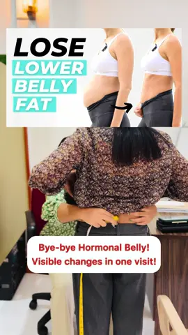 Bye-bye Hormonal Belly!  30 Days Challenge!! #tiktoktainment #pcos #hormonalbelly #bellyfat #healthywomen 