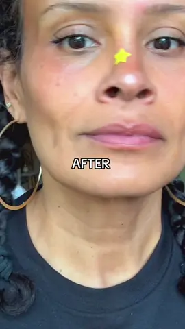 Fine lines? Gone in seconds. Serious Skincare Instatox instantly smooths under-eye wrinkles, forehead lines, and neck creases—without needles. Just dab it on and watch it tighten before your eyes. Perfect for moms who want quick, effortless results and a confidence boost. ✨ #WrinkleSmoother #InstantTightening #MatureSkinCare #MomBeautyHacks #SkinCareOver40