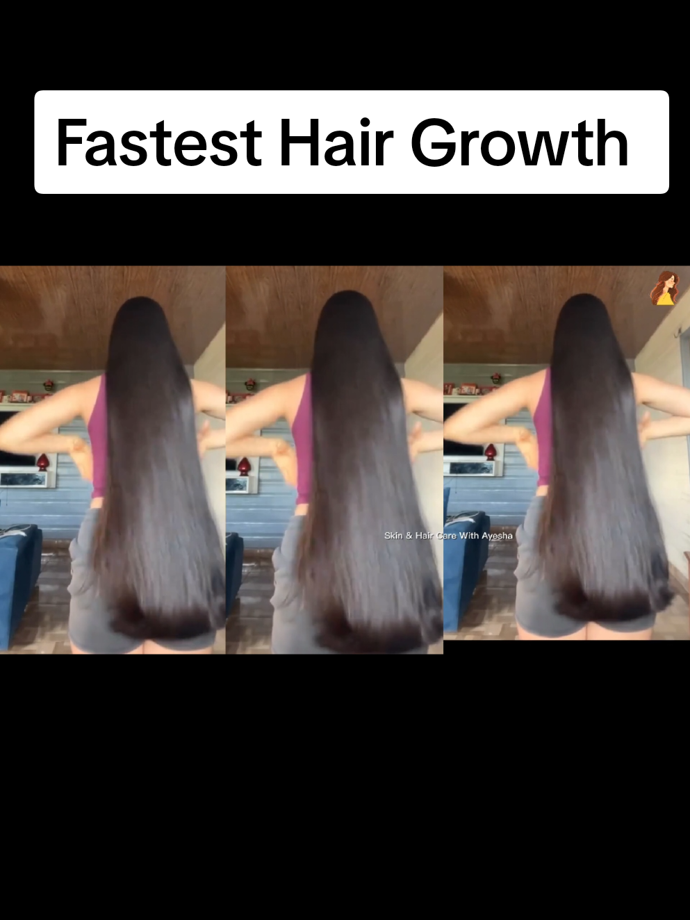 Fastest Hair Growth With Onion 💯 Follow For More ♥️ #foryou #hairgrowth #fyp #haircareroutine #longhair 