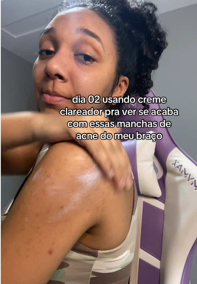 passando 2x no dia pra clarear mais até 🤣 #fyp #acne #manchasdeacne 