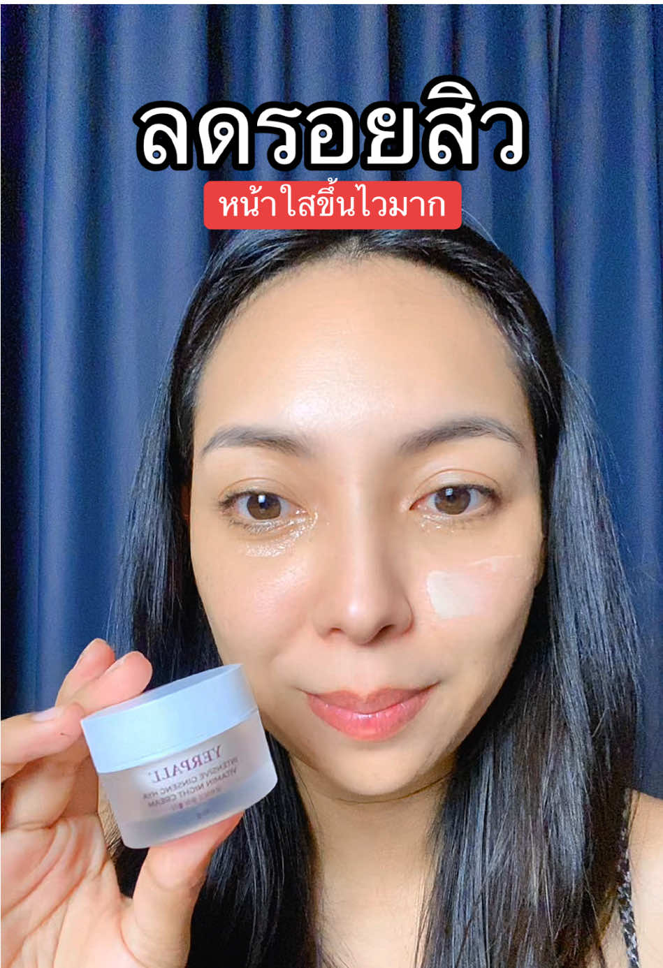ลดรอยสิว หน้าใสขึ้น #yerpallthailand #ครีมโสมไฮยา #สิว #ลดสิว 