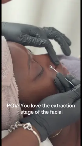 I love all the stages, but extraction is definitely the most satisfying part!  After a deep cleanse and exfoliation, I get right in there to unclog those pores to keep your skin smooth and radiant✨ #fyp #trending #facial #skincare #satisfyingvideos 