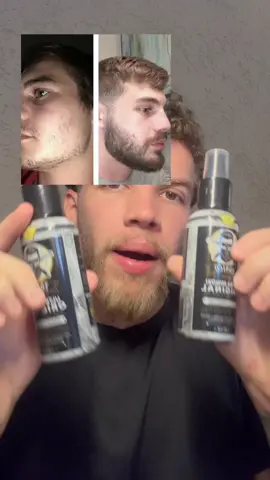 Calvície ou falta de barba, se resolve assim! #barba #calvicie #cabeloebarba #cabelo #minoxidil 