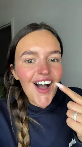 Damage-free teeth whitening has never been so easy! Join millions of satisfied users!