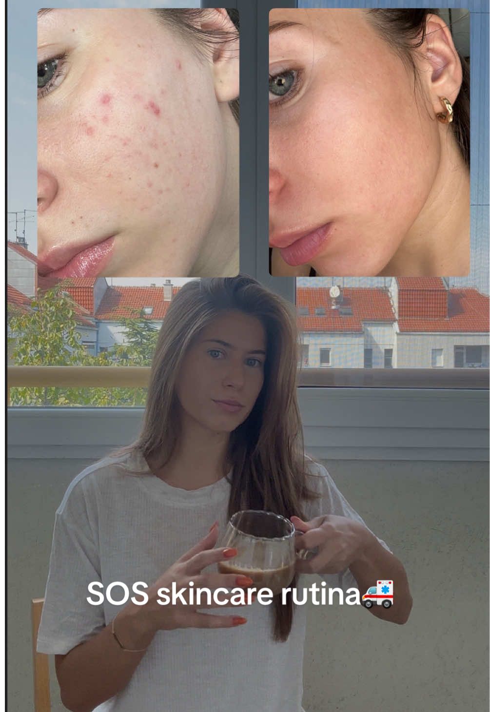 Skincare rutina powered by k-beauty✨   #skincare #kbeauty #sosskincare #clearskin 