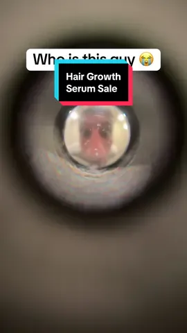 He’s grown so much hair with that roll on serum 😲 #hairgrowth #hairgrowthserum #serum #rollon #hairgrowthtips 