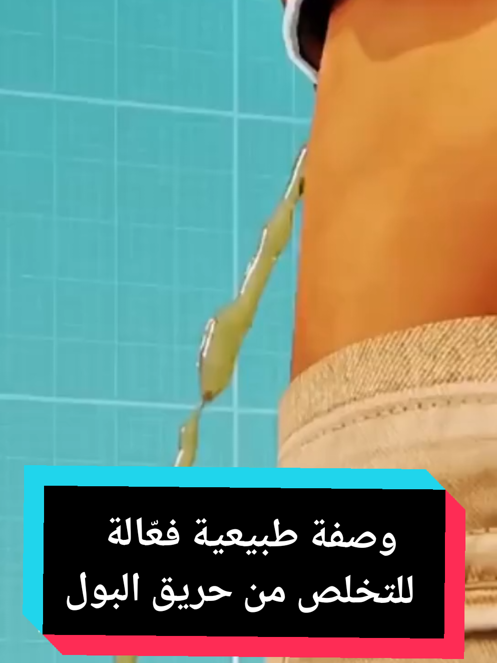 وصفة طبيعية فعّالة للتخلص من حريق البول #وصفات_سهله #البروستات #وصفات_طبيعية #اعشاب_طبيعيه_فوائد #الطب_البديل 