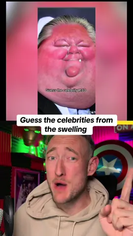 Guess the celebrities from the swelling #game #popculture #filter #funnytiktok #celebrity 