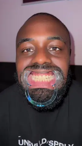 Je vous déconseille sorry
