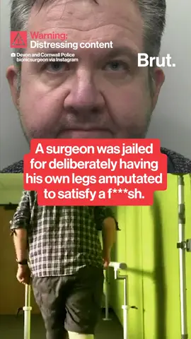 A British surgeon was sentenced to 32 months in prison after deliberately injuring himself to force a double amputation, part of an insurance fraud scheme tied to a sexual fetish. #MedicalCrime #InsuranceFraud #NeilHopper #UKNews
