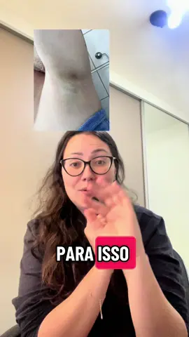 Chega de ter vergonha de usar brusinha 😍😍😍 #serumclareador #clareadordeaxilas #axilasmanchadas #axilasbonitas #clareadordemanchas 