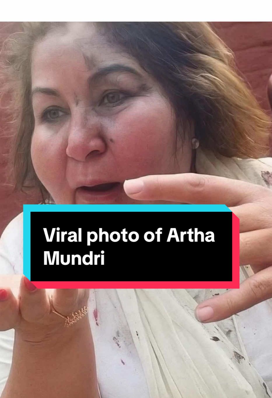I went from this to this. Literally glowing. Follow my route if you want to get this amazing look.🤌🤌 #NepalUpdates #NepalProtests #RamDhulai #YouthVoices #NepalCrisis @BBC News 