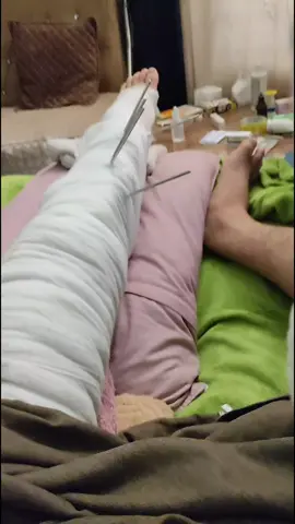 صارلي 20يوم بلاتين خارجي يوم الثلاثاء عمليه ثانيه بلاتين داخلي 💔😡