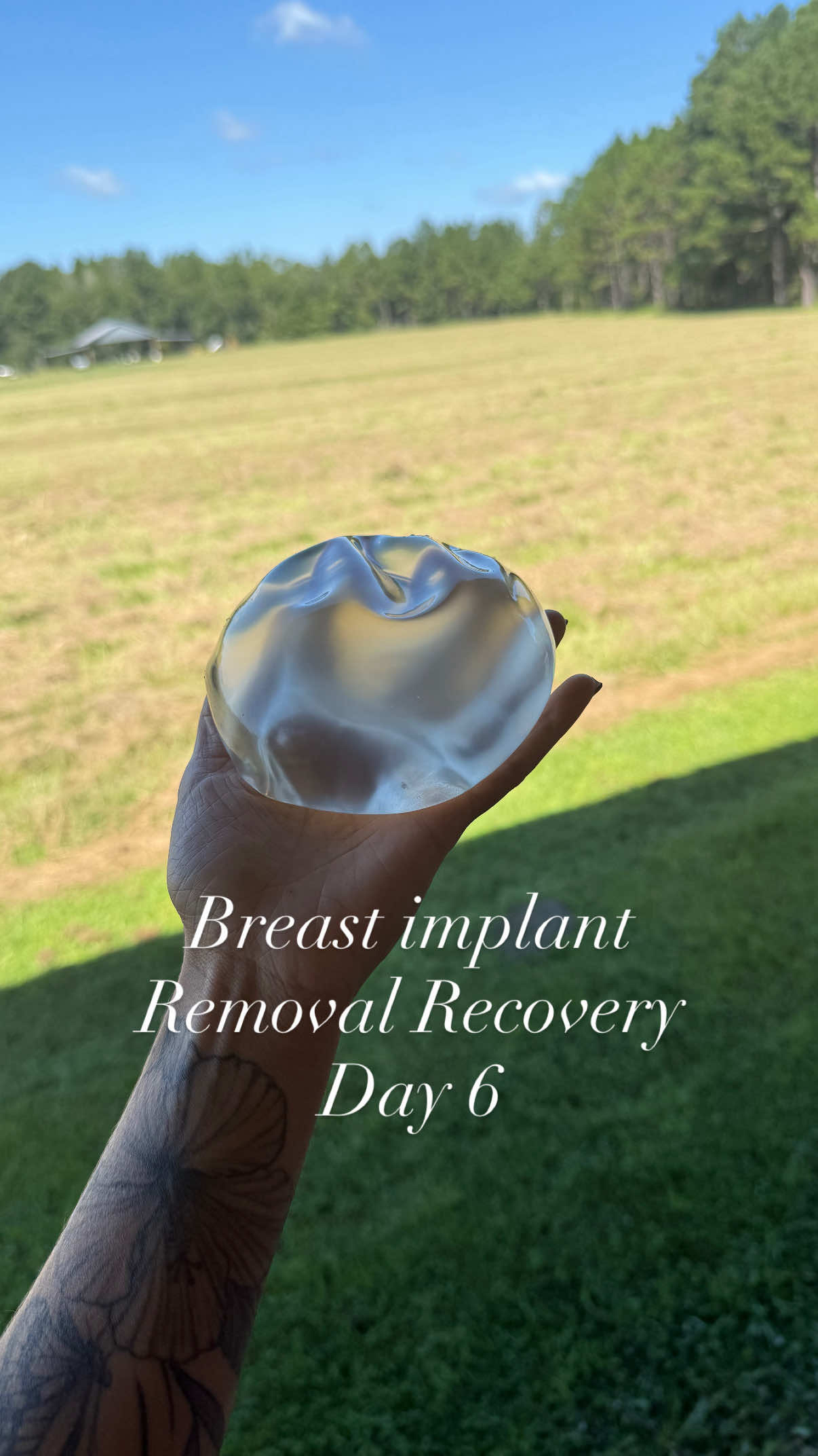 #explantjourney #trending #lifestyleblogger #breastimpant #breastimplamtillnessawareness 