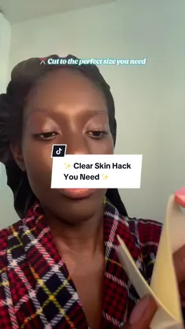 ✨ Clear skin made simple with @dimora medical ✨ These hydrocolloid patches are perfect for pimples & small wounds 🩹 Cut to your size, stay invisible, and heal while you go about your day 💖 Use my code DIMORA1861 for 15% off + shop here 👉 www.amazon.com/dp/B0BNPSCZX2 #tiktokmademebuyit #amazonfinds #pimplepatch #clearskinjourney #selfcareroutine 