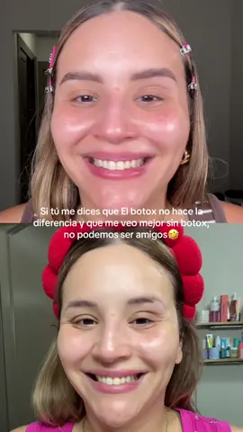 Amiga está es tu señal, aplícate botox y deja que la gente te pregunte después que te hiciste👀🌚 #botox #botoxresults #beforeandafter #agingwell #toxinabotulinica 