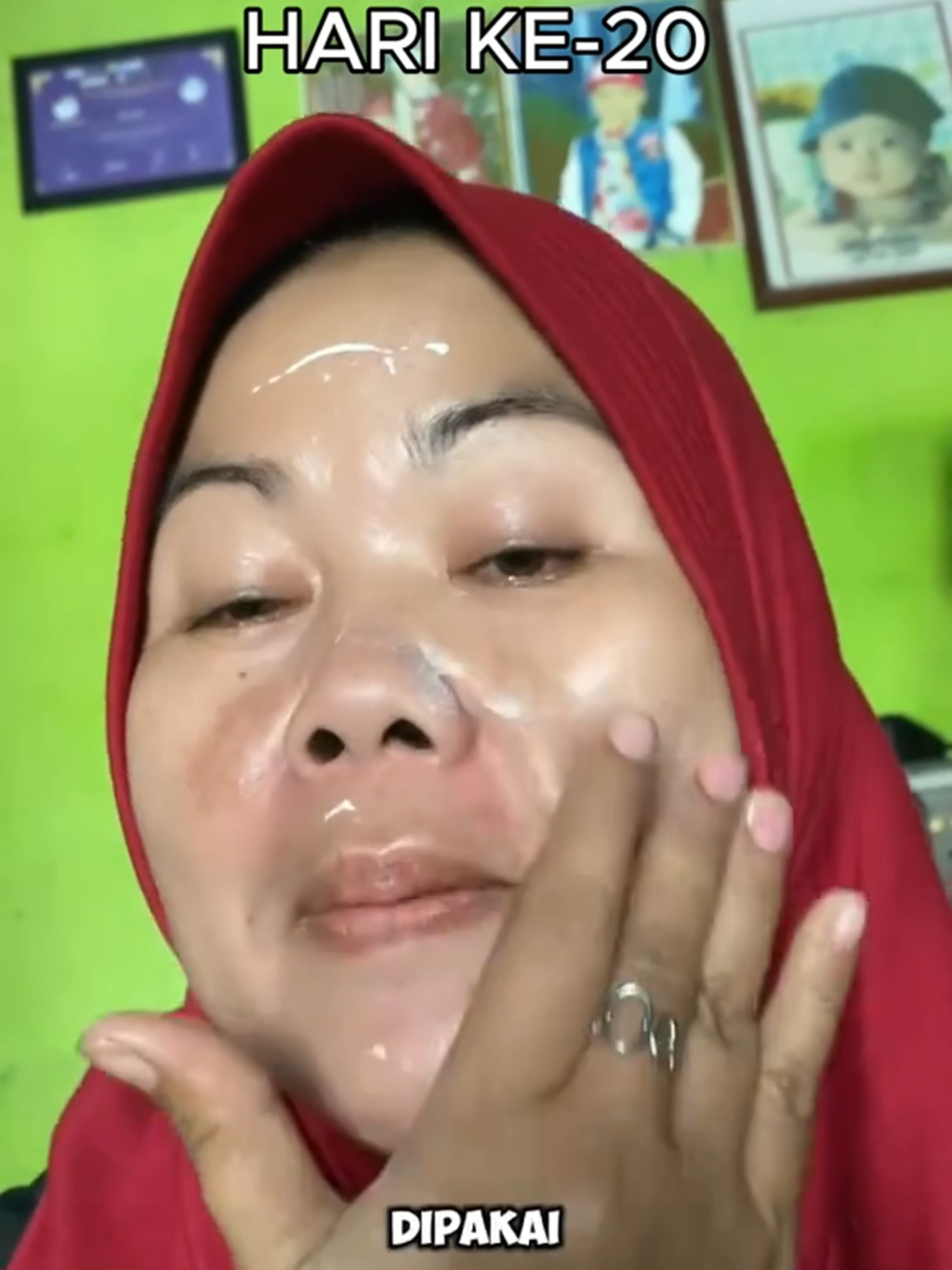 Dulu kusam, sekarang glowing maksimal ✨ #brighteningcreamchalonesee#promoguncang99 #gajiansale #brighteningcream #creampencerah #chalonesebrighteningcream #ForYourBeauty #skincareviral #chalonesecreamwhiteningandfreckleremoval #skincareroutine #skincaretips #chalonese #chaloneseskincare #wajahglowing #cerahglowing #garishalus #solusijerawat #bpomdanhalal✅ #bumilbusuiaman🥰