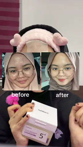 lepasni kena repeat lagi Numbuzin toner pad ni #numbuzin #tonerpad #skincare #fyp #acne 