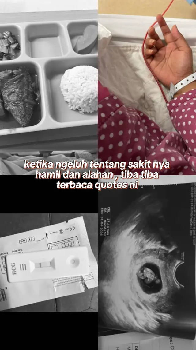 #baby2026comingsong💕 #trimester1 #sihatselaluanakkusayang #bumilsehatbayisehat🤰♥️😘😘 