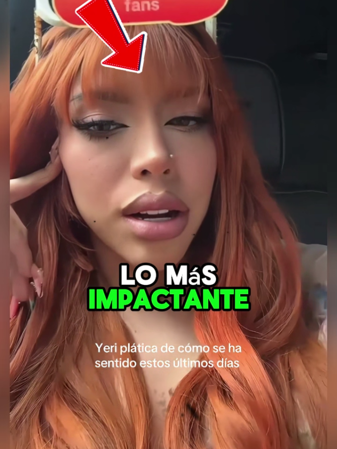 ¿Que le pasó a Yeri Mua? #noticias #ultimahora #noticiasdeultimahora #yerimua #lonche  Todo lo que se muestra en este video es con finos informativos.