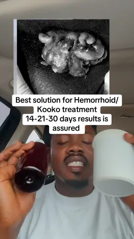 Best solution for Hemorrhoid/Kooko treatment  14-21-30 days results is assured #testimony #richeweherbaltips #ewecommunityherbstips #fyp #foryoupage 