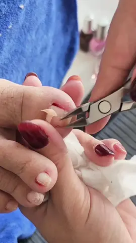 cắt da lấy khóe#ghienlaykhoe #ngocanhtocanails #xuhuongtiktok #kemlam 