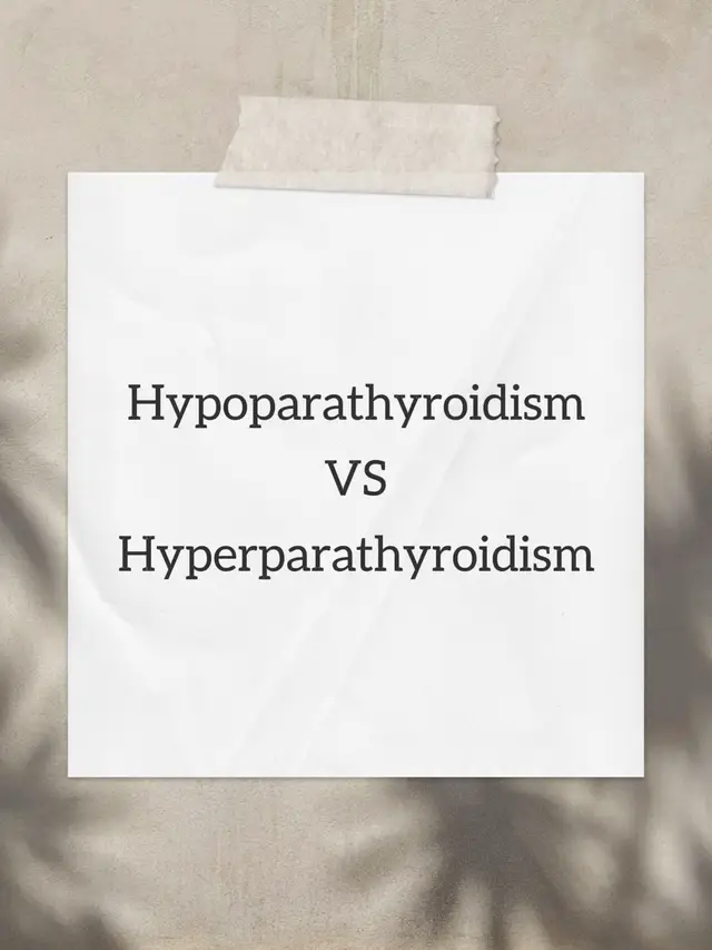 Hyperparathyroidism (Overactive parathyroids → ↑ PTH) Types Primary – usually due to a benign adenoma, hyperplasia, or (rarely) carcinoma. Secondary – compensatory increase in PTH due to chronic low calcium (e.g., chronic kidney disease, vitamin D deficiency). Tertiary – autonomous PTH secretion after long-standing secondary hyperparathyroidism (often in renal patients). Effects High PTH → High calcium (hypercalcemia) + Low phosphate (hypophosphatemia) Bones, stones, abdominal groans, psychic moans. Bone pain, osteoporosis, fractures. Kidney stones, polyuria.. GI issues: constipation, peptic ulcers, pancreatitis. Neuro: fatigue, depression, confusion Management Primary: Surgery (parathyroidectomy) if symptomatic or severe; otherwise monitor. Secondary: Treat underlying cause (e.g., phosphate binders, vitamin D, dialysis). Hydration, bisphosphonates, calcimimetics (cinacalcet) may help. Hypoparathyroidism (Underactive parathyroids → ↓ PTH) Causes Most common: post-surgical (thyroid/parathyroid surgery). Autoimmune destruction. Genetic syndromes (DiGeorge syndrome). Low magnesium (needed for PTH secretion Hypoparathyroidism (Underactive parathyroids → Effects Low PTH → Low calcium (hypocalcemia) + High phosphate (hyperphosphatemia) Symptoms of hypocalcemia: Tingling around mouth, hands, feet Muscle cramps, spasms (tetany), carpopedal spasm Chvostek’s sign (facial spasm when tapping cheek) Trousseau’s sign (carpal spasm with BP cuff inflation) Severe: seizures, cardiac arrhythmias).