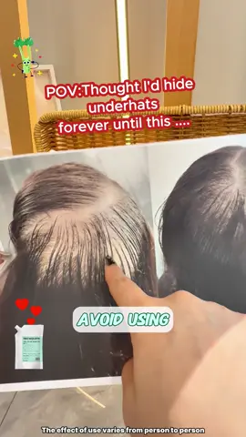 TikTok's hottest shampoo, buy one get one free for a limited time. #fyp #hairloss #tricholoy #hair #growyourhair 