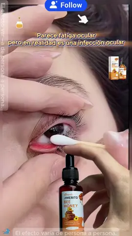 Jimerito Honey For Eyes, Refreshing, Moisturizing And Soothing Eye Drops For Dry And Astringent Eyes#LanguageLearning #eyes #honey #eyehealth #eyecare 
