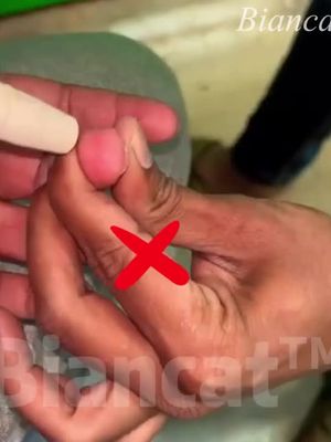 99% Accurate, No More Finger Pricks! Adiós $2K Costs with Family-Friendly, FDA-Compliant Meter.