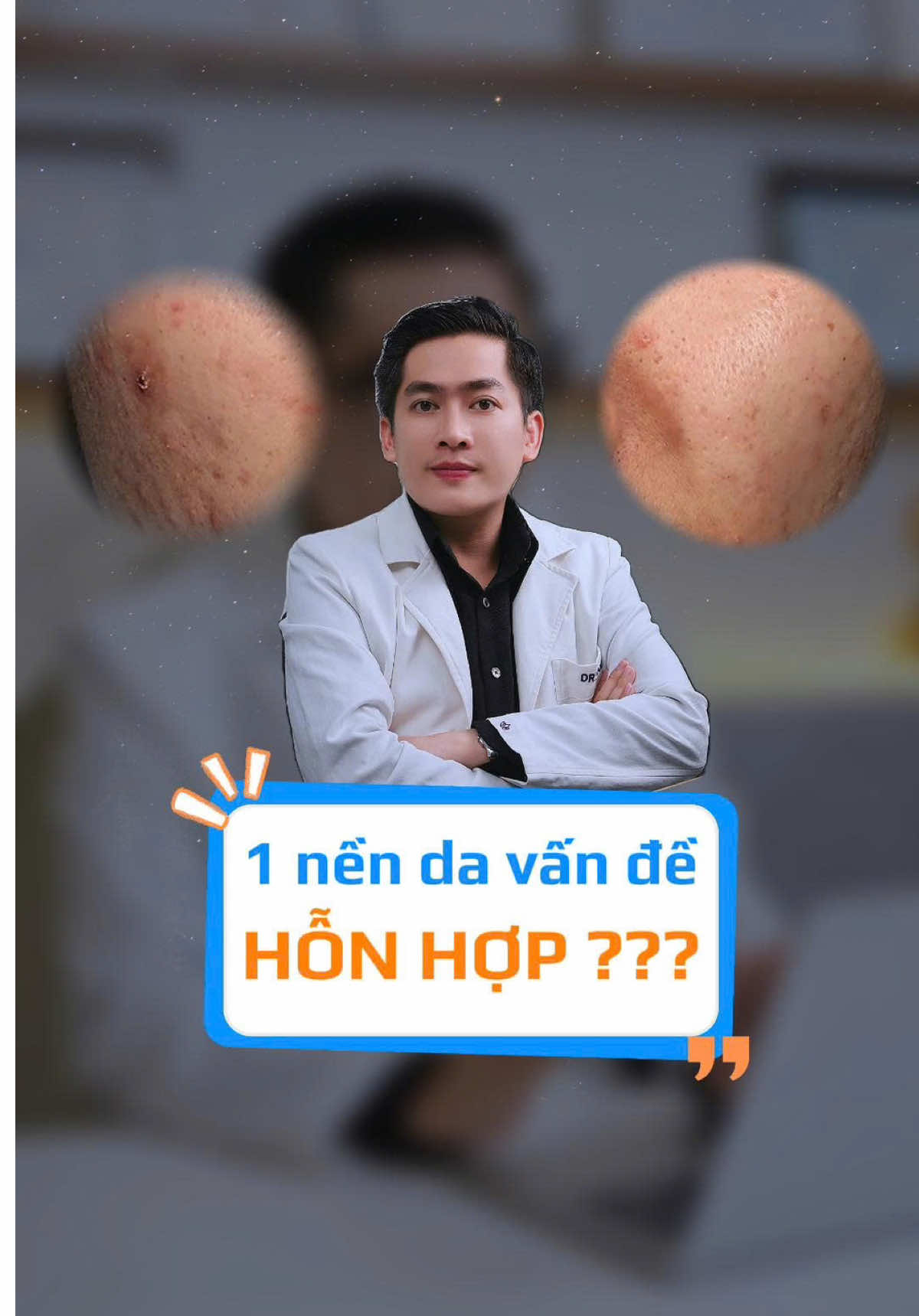 Xử lý case da nhiều vấn đề: th.âm, m.ụn viem, mun ẩn, lcl to,... #drnamvo #dalieu #chamsocda #chamda #chamscareroutine  