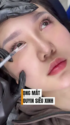 Bọng mắt Douyin siêu nét tại Huệ Anh #bongmatcuoi #tiembongmat #tranhueanhfiller #xuhuong #lamdep 
