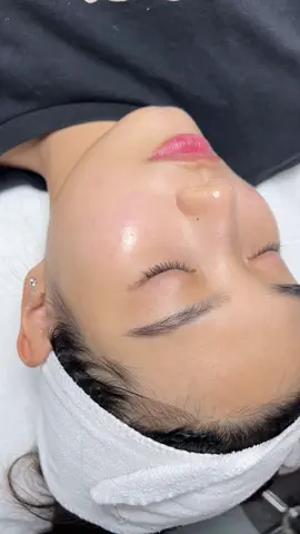 Nói gì thì nói, da đẹp vẫn thật ưng, glow, căng mướt. Ai mà ngờ thời gian trước cô bung bét mụn, thâm với vòng luần quẩn chăm da phụ thuộc đi spa mà không quan tâm đồ bôi tại nhà