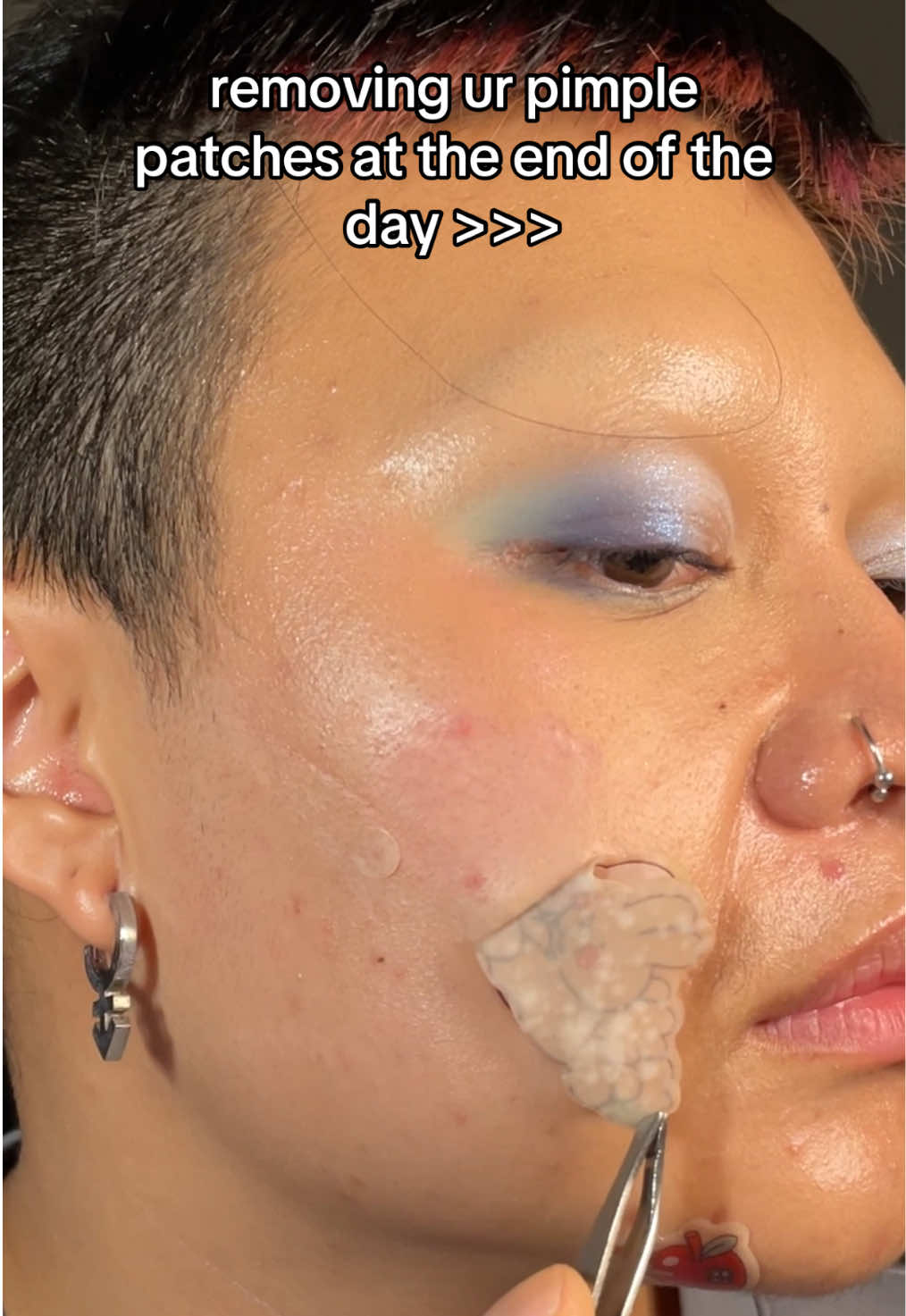 it’s like taking off ur bra after a long day 🙂‍↕️ #acne #pimplepatchremoval #pimplepatch #satisfying 