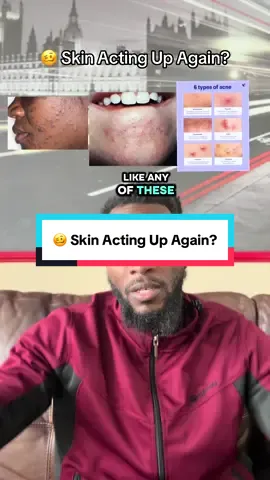 🥴 Skin Acting Up Again? The Beplain Skin Detox Trio Filter Cleanser is your simple 3-step reset for clear, calm, and hydrated skin. 🌿💧 Say goodbye to clogged pores, breakouts, and flaky patches—and hello to smooth, radiant “glass skin.” 💎 What’s Inside: ✅ Oil Cleanser – lifts makeup & deep buildup ✅ Rinsing Cleanser – purifies gently, no dryness ✅ Clay Mask – refines pores & soothes stressed skin ✨ Real skin, real glow—no filter required. 🚨 On Flash Sale now—don’t miss your chance to glow up! @beplain.shop  #koreanskincare #beplainfilterskin #tiktokshoprestock #beplainskindetox #beplain