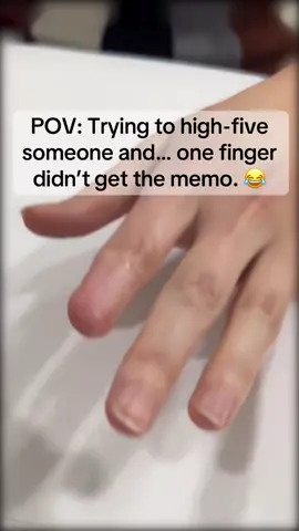 POV: Trying to high-five someone and… one finger didn’t get the memo. 😂