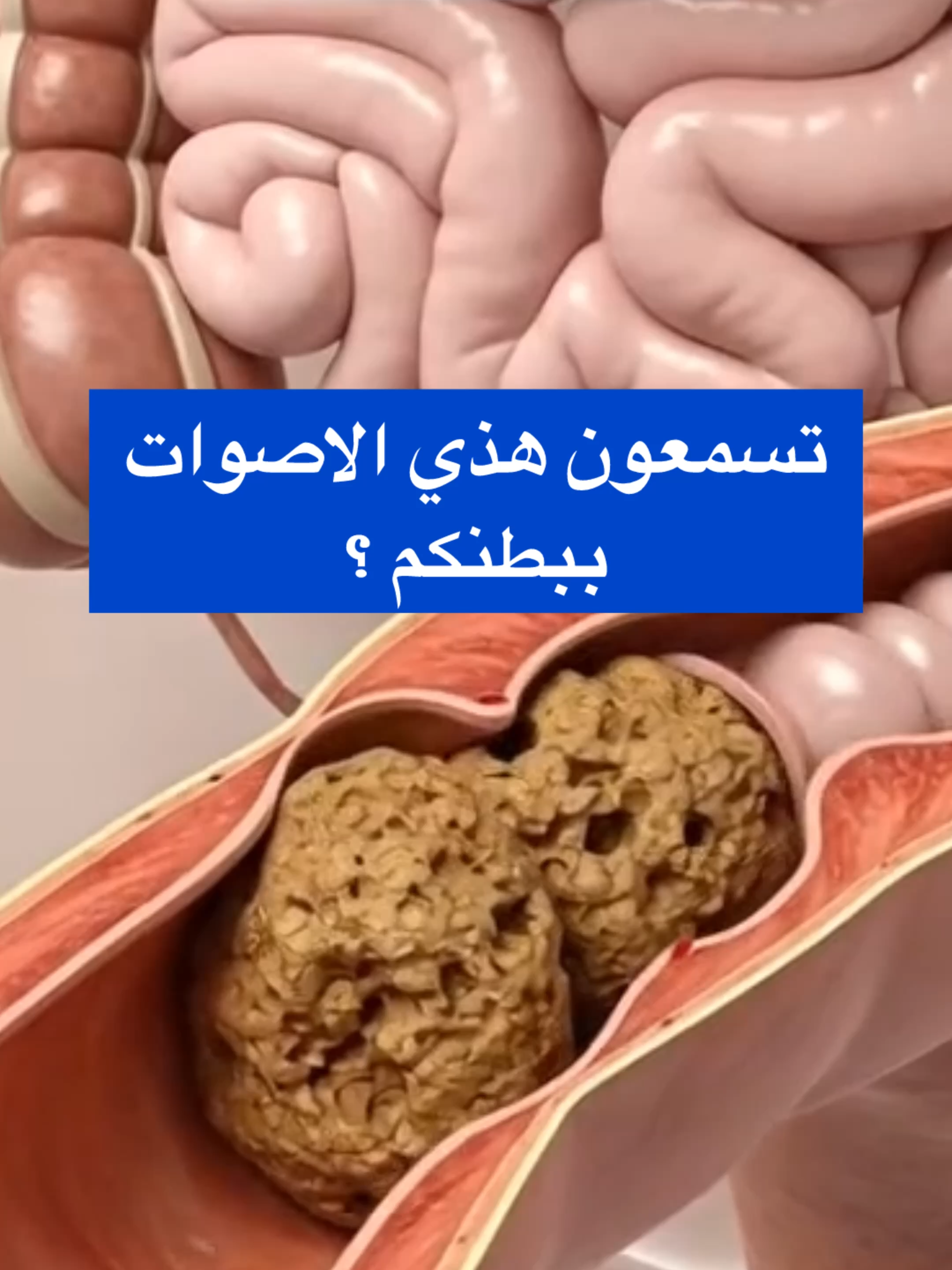 #سِيبُو #صحة_الجهاز_الهضمي #انتفاخ_البطن #بكتيريا_الأمعاء #السعودية #السعوديه #الشعب_الصيني_ماله_حل😂😂 #الشعب_الصيني_ماله_حل #اكسبلوررررر #عشبة_اليانسون #جدة #المدينه_المنوره #مكه #مكه_المكرمه #الاحساء #ضحك #الهم_صلي_على_محمد_وأل_محمد #الغم #الكرب #جبل