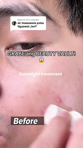 Grabe ang BEAUTY VAULT REJUV! Iba din talaga ang BILIS ng Resulta!!!😱🧡👏 Salamat sayo #BeautyVault Rejuv! ✨✨✨