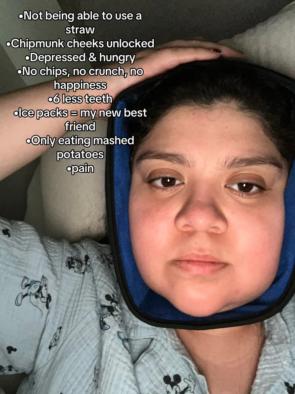 Not the wisdom teeth humbling me like this 🥲 #wisdomteeth #wisdom #wisdomteethrecovery #wisdomteethremoval #wisdomtooth 