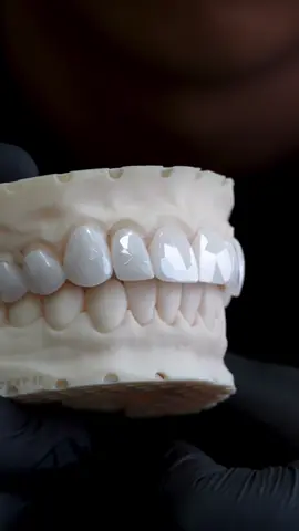 DIAMOND CUTZ VENEERS 💠 powered by @Karat Lab 