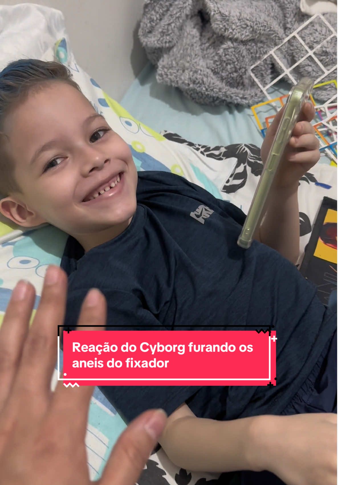 Reação do Cyborg ao furar a Pernica de ferro 🔧🔩🦿 #mateuscyborg #fixadorexterno #alongamentoosseo #gambiarra #ortopedia 