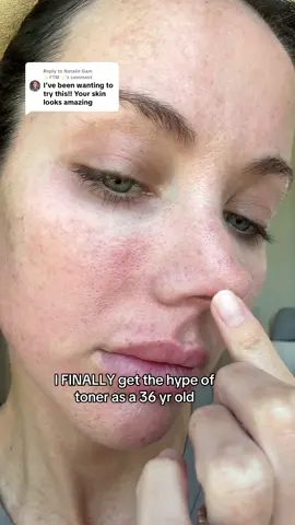 Replying to @Natalie Gam ✨FTM✨ never missing this dang step again  #clearstem #clearstemskincare #toner #skinbrightning 