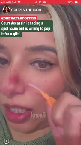 Episode 1538 | #courtassassin has a spot issue. #fyp #uktiktok #drpimplepopper 