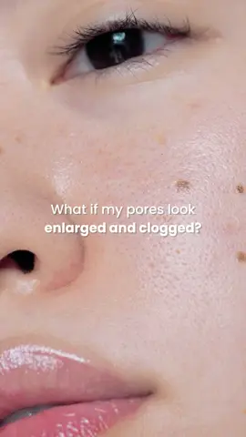 Kenapa sih pori-pori keliatan makin besar? 🤔 Karena minyak, kotoran, dan dead skin cells ngumpul, bikin kulit keliatan dull & kusam. Solusinya? Capsibright Bubbling Mask Cleanser!  Pembersih 2-in-1 yang bikin kulit bersih tuntas + instant bright! #poriporibesar #masalahkulit #skincareroutine #skincaretips #biobeautylab 
