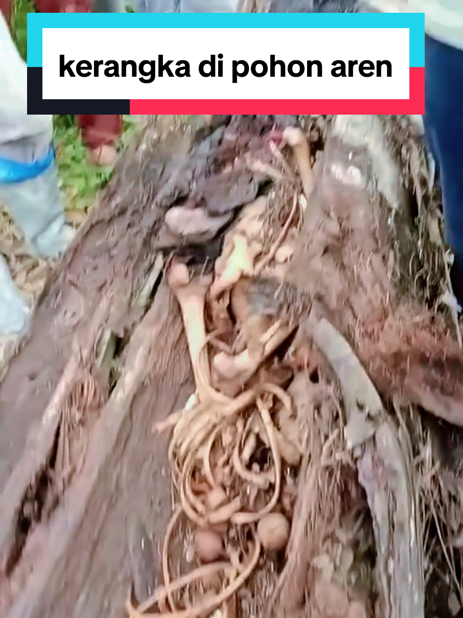 Polisi masih menyelidiki penemuan kerangka manusia di dalam pohon aren di Sei Rampah, Serdang Bedagai, Sumatera Utara (Sumut). Begini awal mula penemuannya. Dilansir Antara, Kamis (11/9/2025), kerangka manusia mulanya ditemukan warga setempat bernama Rian (17) pada Selasa (9/9/2025). Saat itu, Rian bersama dua rekannya tengah memanen buah sawit. Rian melihat tulang di dalam pohon aren yang sudah tumbang dan mati. Dia lalu memberanikan diri membuka pohon aren tersebut. Baca juga:Polisi: Ada Warga Kenali Baju-Celana Kerangka Manusia Dalam Pohon di Sumut Saat batang dibuka, Rian terkejut melihat kerangka manusia dalam kondisi masih lengkap di dalam pohon aren tersebut. Sontak temuan itu menjadi tontonan warga. Polisi mengimbau warga yang merasa kehilangan keluarganya untuk melaporkan ke polsek setempat. Polisi bersama tim Inafis juga sudah turun ke lokasi untuk mengevakuasi kerangka manusia tersebut. #kerangka #pohonaren #korban #fypage #beritaviral