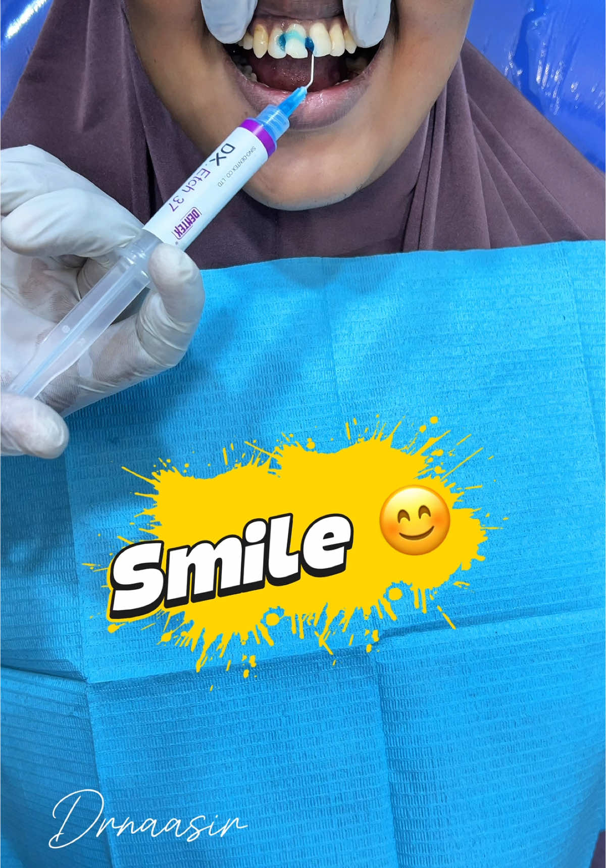 📍Filling Tooth 🩺 #dentist #ilkaha #somalidentist #muqdisho #viral #somalitiktok #kakaaftooncabashada🇸🇴🦷🇲🇾 