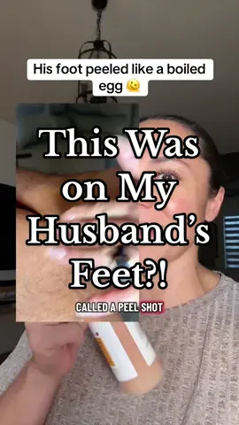 This exfoliating spray literally MELTED the dead skin off my husband’s feet; no scrub, no blade, just results #DeadSkinSpray #KojicAcidPeel #TikTokShopFinds #tiktokshoprestock  #TikTokShopBlackFriday 