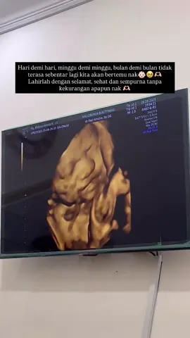 Masyaallah Tabarakallah 🥹🫶🏻 Lahirlah dengan sehat, selamat dan sempurna tanpa kekurangan satupun nak. Kami menunggumu dengan penuh cinta🫶🏻🥰 @dheanhandika #tm3 #pregnancy #usg4d 